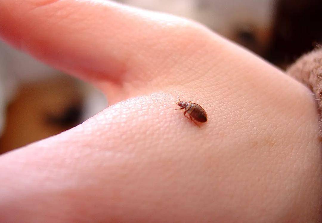 The body is always inexplicably itchy, check your bed!